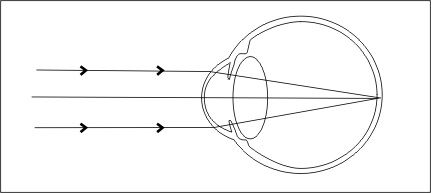 Lentille