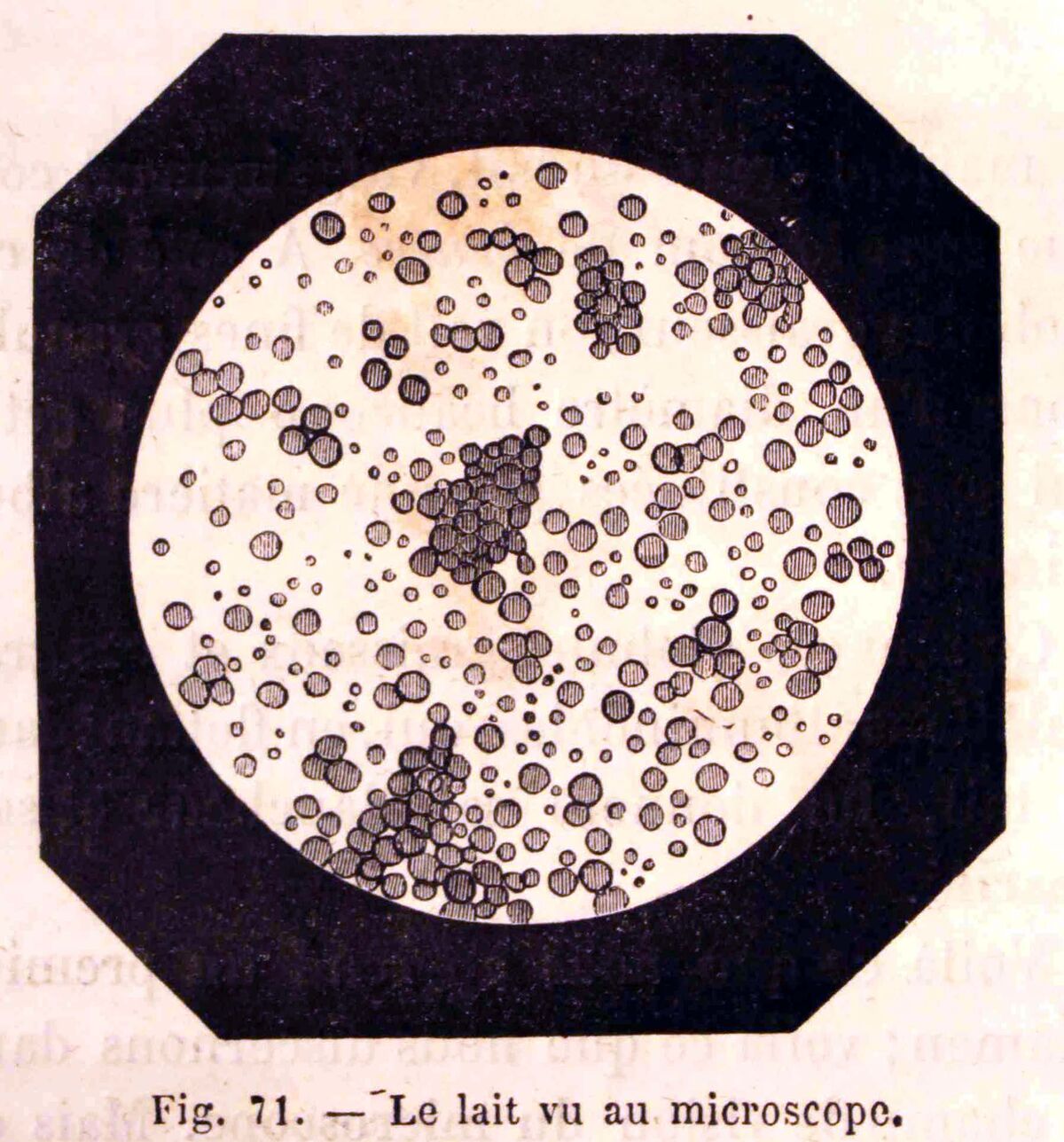 A milk sample viewed under the microscope.