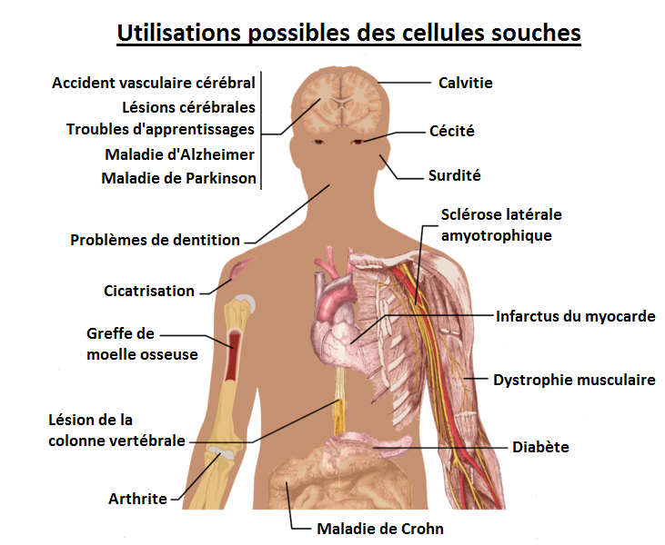 Maladies