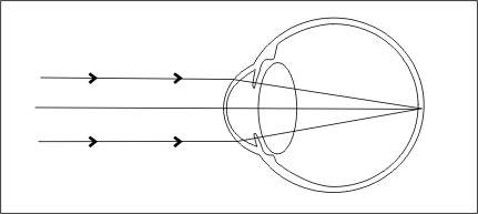 Oeil emmétrope 