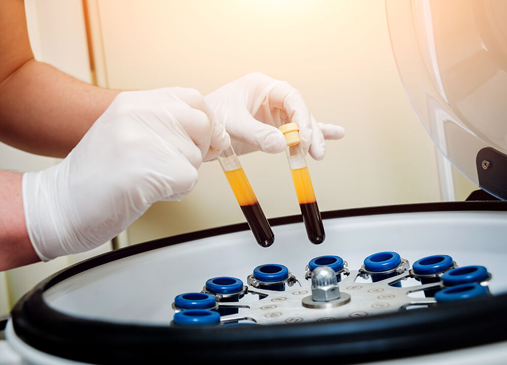 Separation of red blood cells and blood plasma