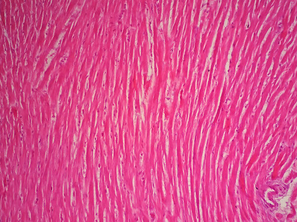 Heart muscle tissue