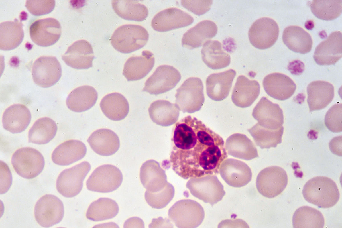 Blood seen under a microscope.