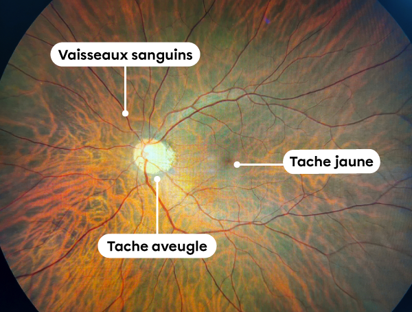 Les diverses structures de la rétine