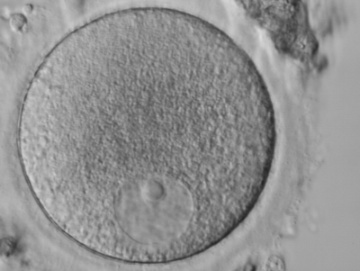 An immature ovum (oocyte).