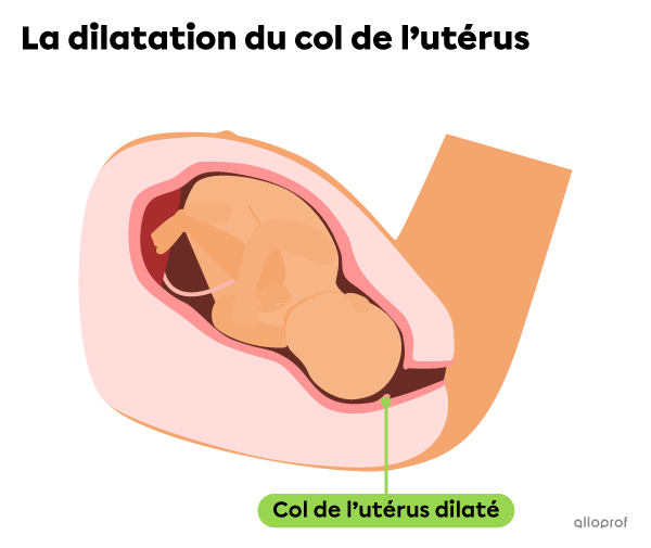 Pendant la dilatation, le col de l’utérus se dilate.