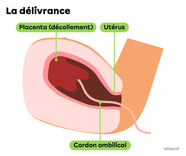 Lors de la délivrance, le placenta et le cordon ombilical sont expulsés.