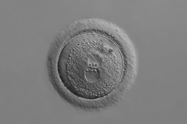 A zygote under an electron microscope.