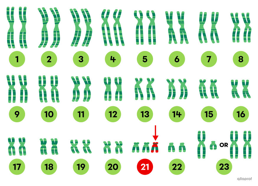 Karyotype of the chromosomes of a human with trisomy 21 (Down syndrome)