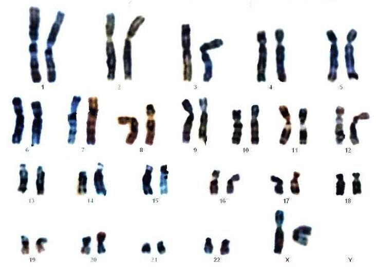 Chromosomes of a Woman