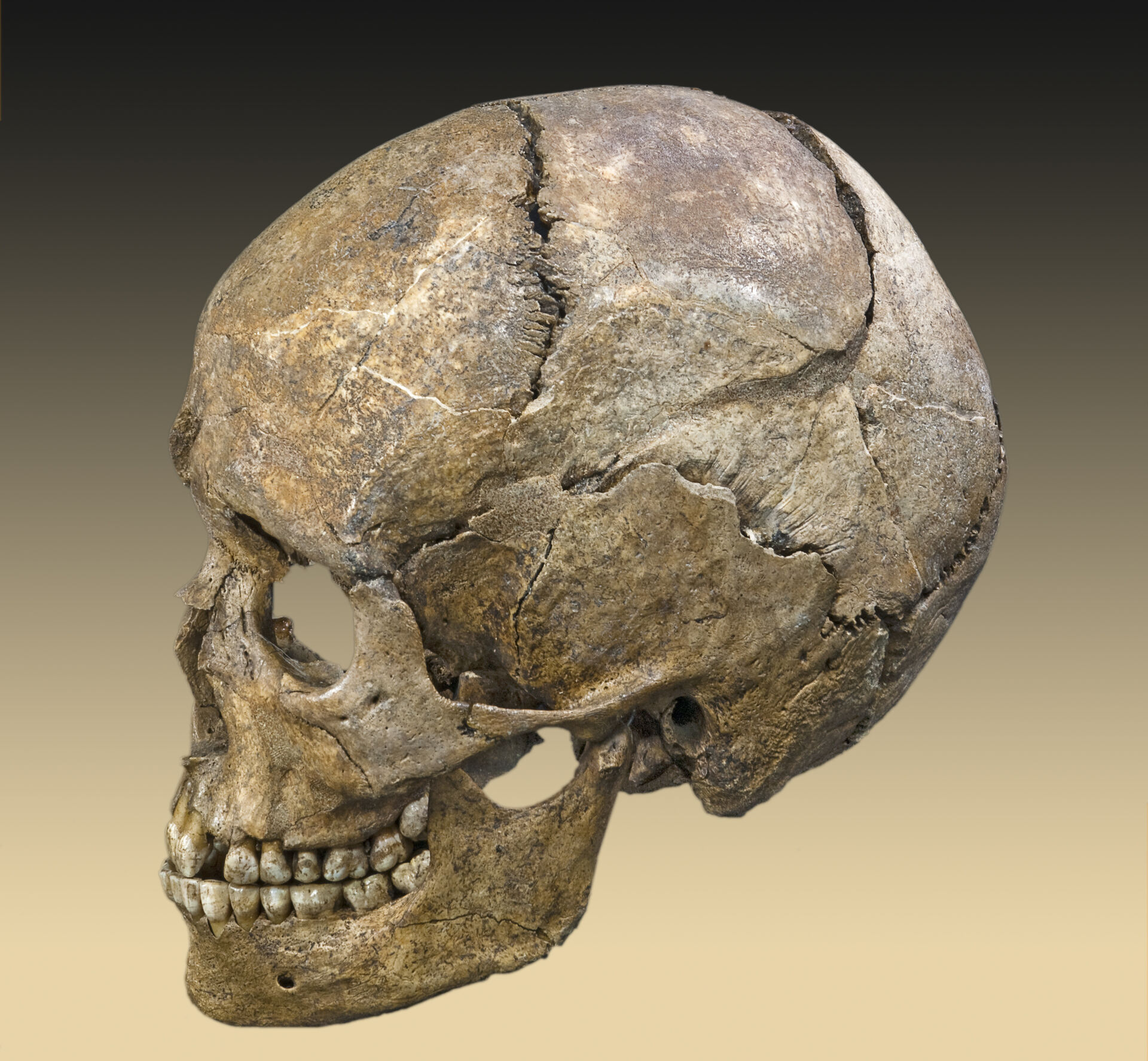 The bones of the skull are connected by fixed joints.