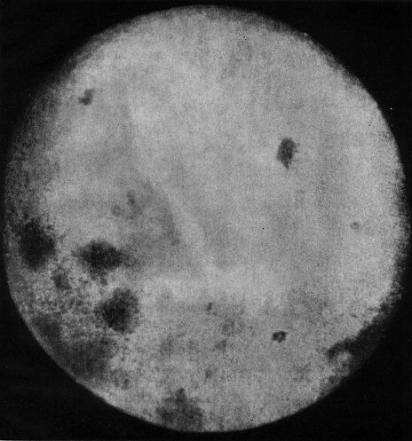la face cachée de la Lune