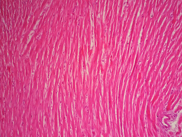 Tissu musculaire du coeur