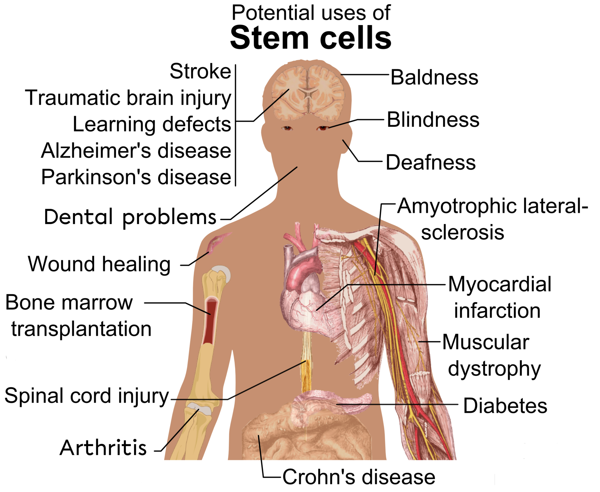 Diseases
