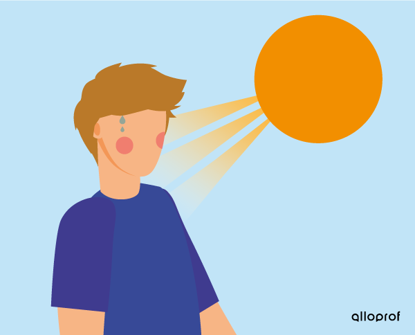 Sunburn.