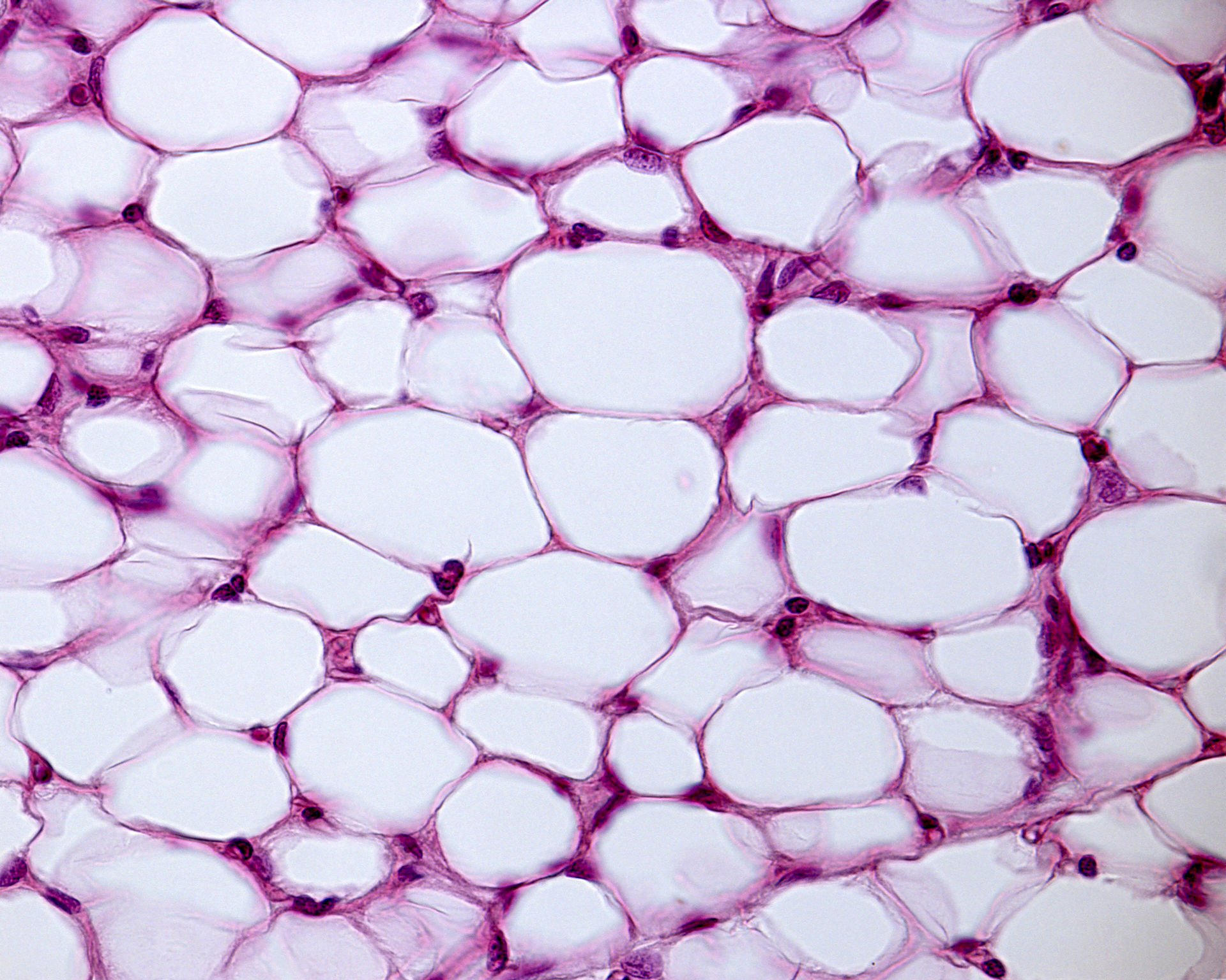 Cellules adipeuses observées au microscope