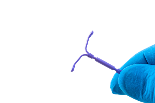 A hormonal IUD.