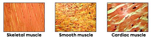 Three types of muscle tissue. 