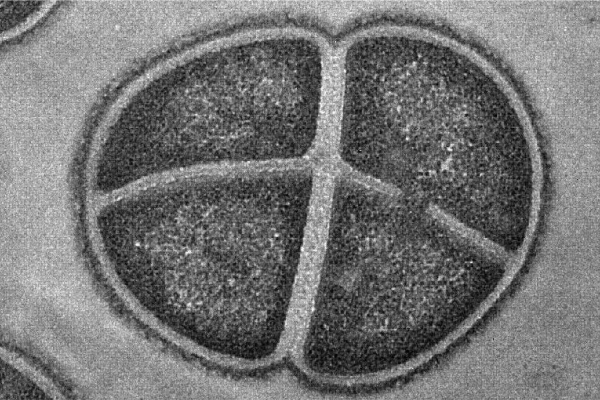 A transmission electron micrograph image of an extremophile bacterium called Deinococcus radiodurans. It is resistant to extreme levels of ionizing radiation and desiccation. 