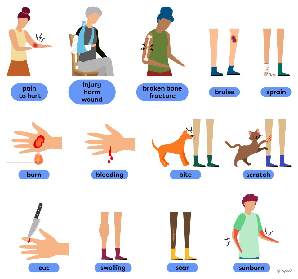 Pictures illustrating vocabulary words for physical harm. Pain and to hurt (person holding her shoulder, saying “ouch”); injury, harm and wound (person with an arm in a cast); broken bone and fracture (arm with a broken bone); sprain (bandaged ankle); bruise (black and blue knee); cut (bleeding finger next to a knife); burn (lit match next to a hand); bite (dog biting a leg); scratch (cat next to a scratched up leg); swelling (a swollen leg next to a normal sized leg); bleeding (drops of blood coming from a